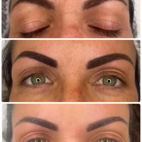 Resultado de micropigmentación de cejas: antes y después del tratamiento
